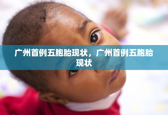 广州首例五胞胎现状，广州首例五胞胎现状