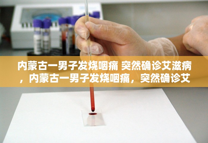内蒙古一男子发烧咽痛 突然确诊艾滋病，内蒙古一男子发烧咽痛，突然确诊艾滋病